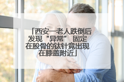 西安一老人跌倒后发现“异常” 固定在股骨的钛针竟出现在膝盖附近